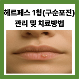 헤르페스 1형(구순포진) 원인·관리·생활 루틴 총정리